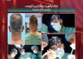 نشتەرگەریا جوانکاریا گوهی
