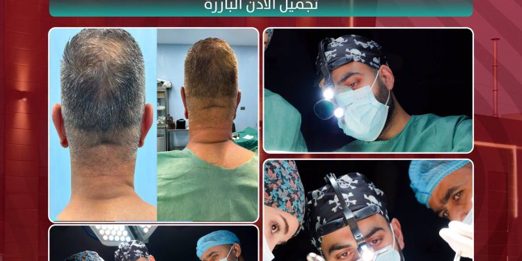 نشتەرگەریا جوانکاریا گوهی